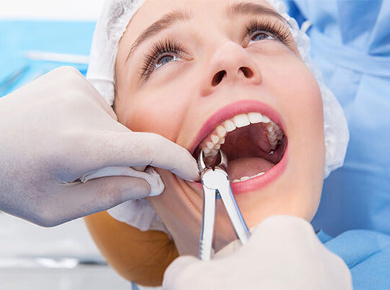 Tooth Extraction